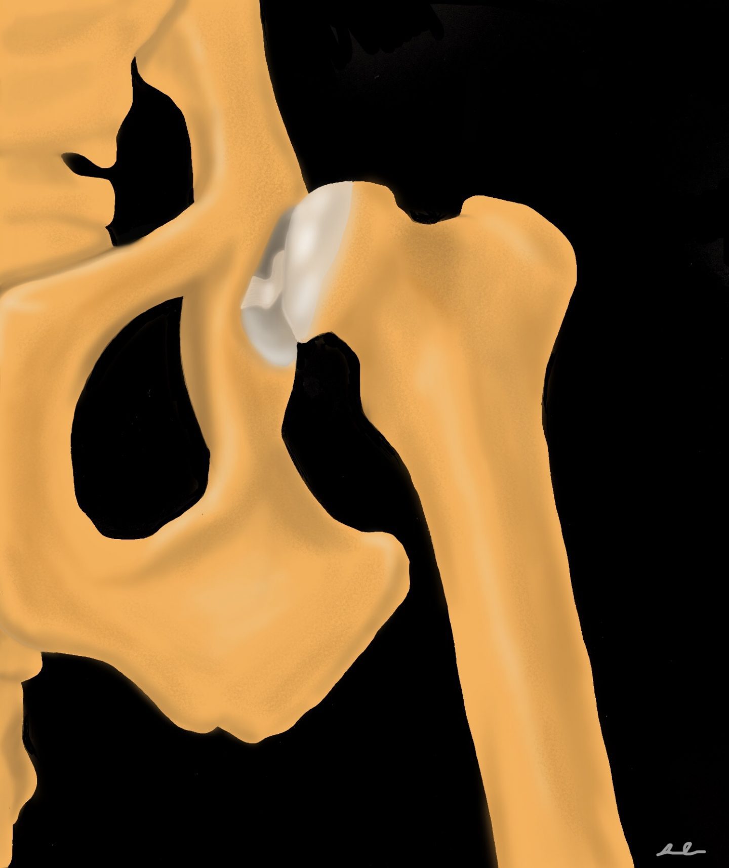 Developmental Orthopedic DiseaseWhat is Hip Dysplasia? Canine
