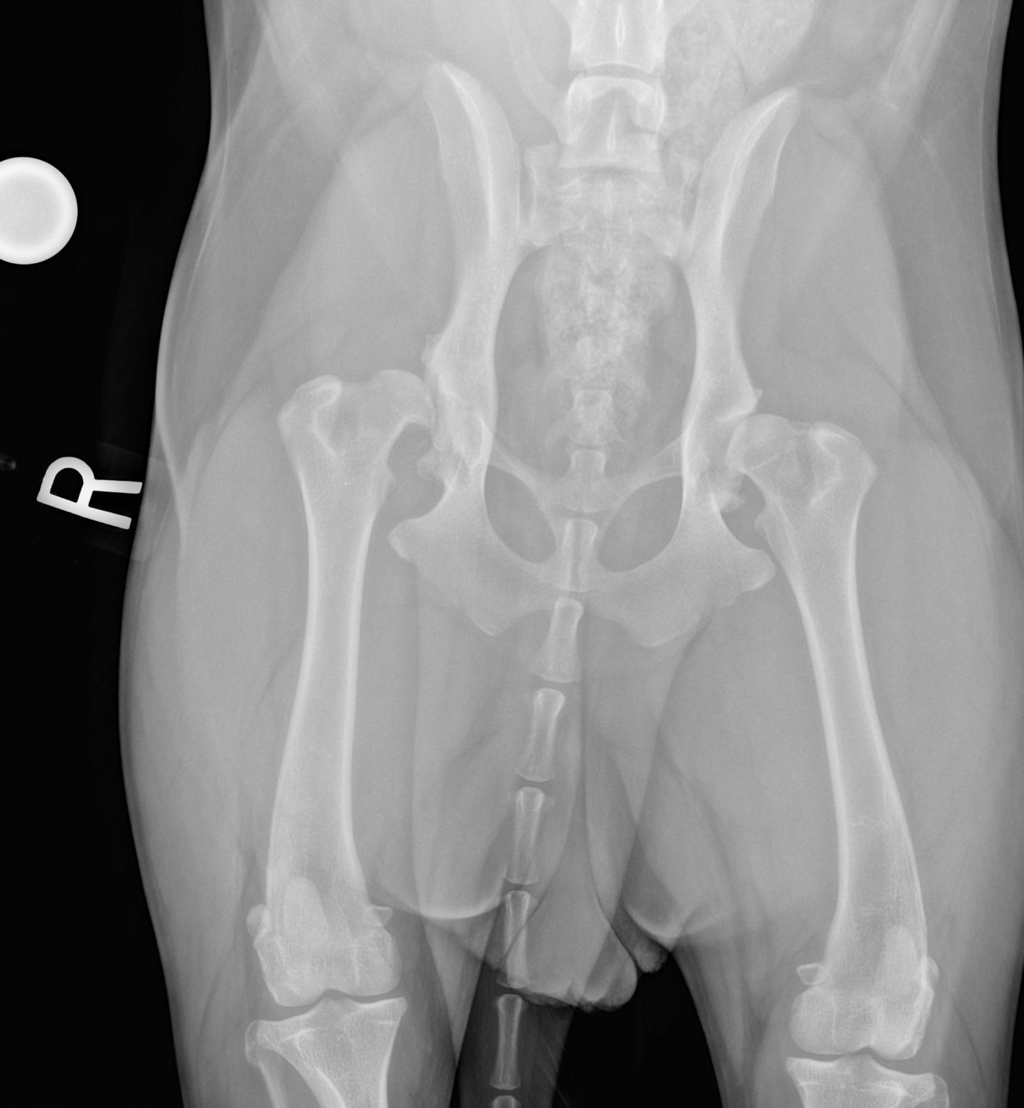 Early Diagnosis Of Oa: Identifying Dods 